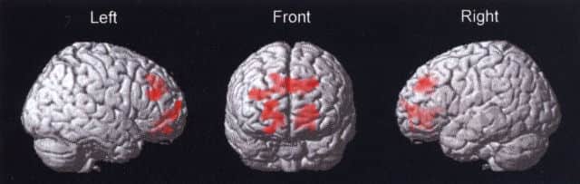 非侵襲脳活動計測(fMRI)データ